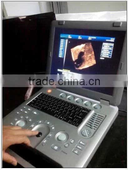 (MSLCU18)3D 4D Handheld Color Doppler Medical Ultrasound Scan Machine photo-5