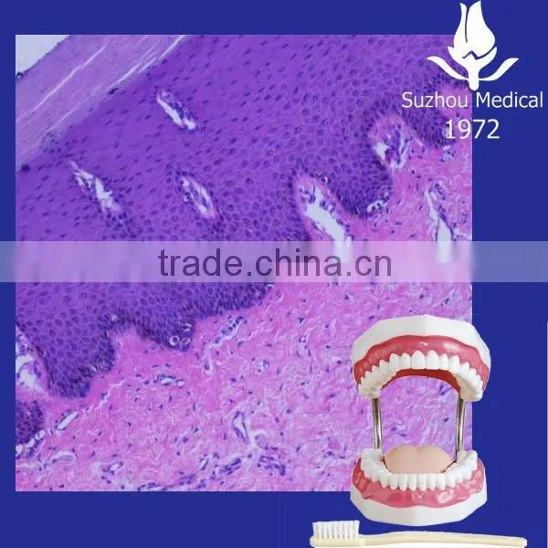 Oral Pathological Slides