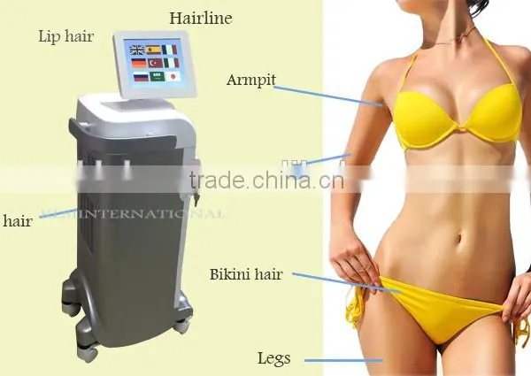 Painless Lip Face and Body Quick Hair Removal Loss Hair Removal Diode Laser photo-5