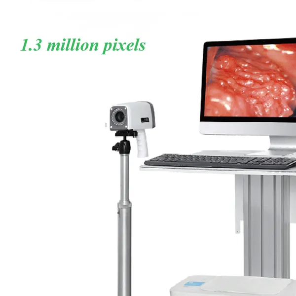 High Definition Digital Electronic Colposcope photo-3