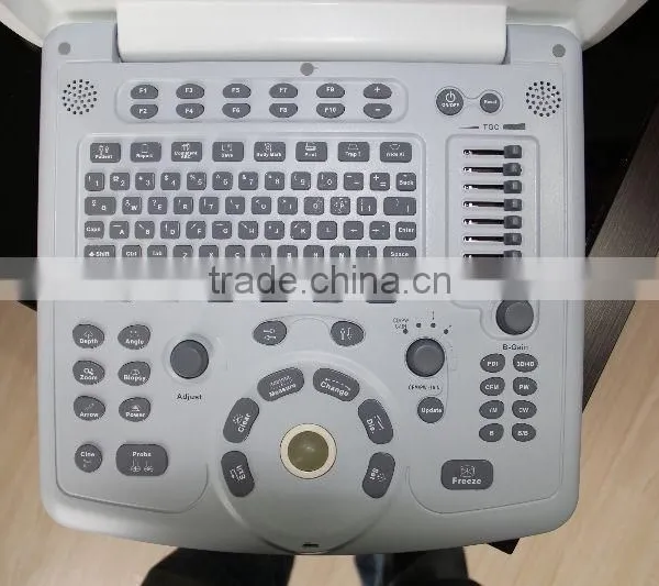 Hot Sale Color Doppler Ultrasound Machine for Sale photo-3
