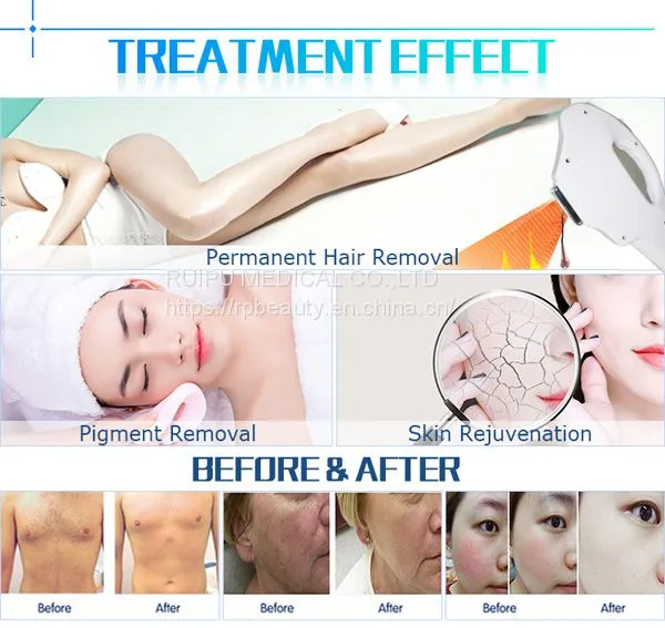 Model-HKS811B Vertical Professional IPL Laser Machine for Sale photo-5