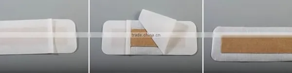 Silver Ion Wound Dressing With CE FDA ISO13485 photo-2