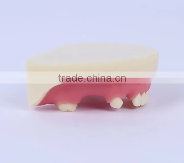 Trade Assurance Hot Dental Implant System CE Approved Dental Implant Model photo-3