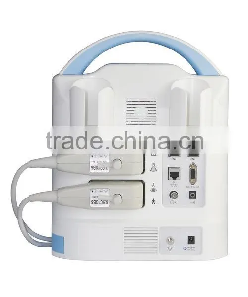 Color LED Backlight Display Cheap Veterinary Ultrasound Scanner Price KX5600 photo-3