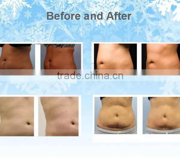 Slimming Reshaping 2016 Hot Selling Cryolipolysis Fat Freeze Slimming Machine For Weight Loss Salon Reduce Cellulite photo-6