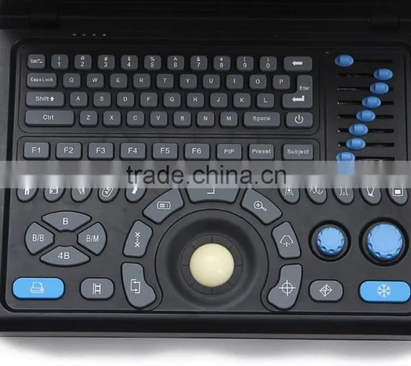 Notebook/Laptop RUS-9000E2 Portable Ultrasound Scanner/machine With Convex Probe, Linear, Vaginal, Rectal Probe-Shelly photo-5