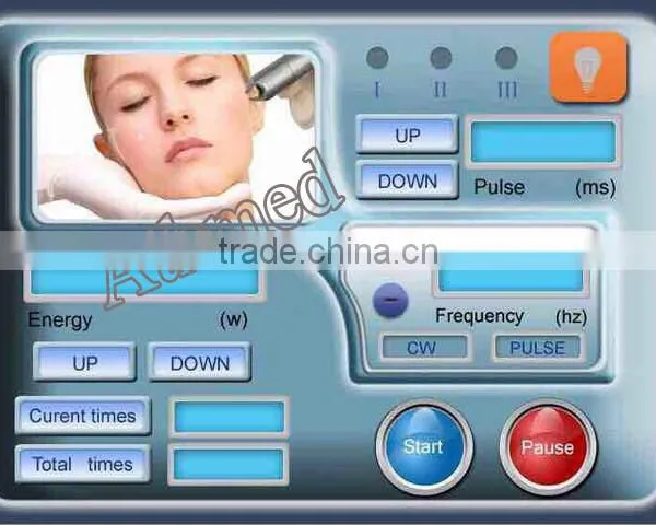 980nm Diode Laser, 980nm Medical Diode Laser, Vascular Removal photo-2