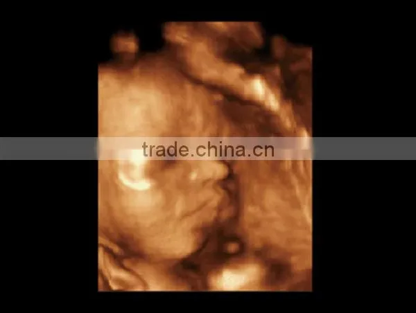 2016 New Portable Color Doppler(Optional 4D) for Cardiac Use photo-6