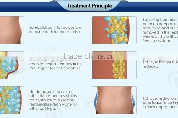 CE / FDA Approved 2 Cryo Handles Cellulite Lipo Slim Cellulite Reduction Fat Freezing Liposuction Machine photo-5