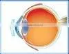 KER for Keratoconus/High-end MCT Technology/Rigid Gas Permeable Contact Lens for Orthokeratology photo-2