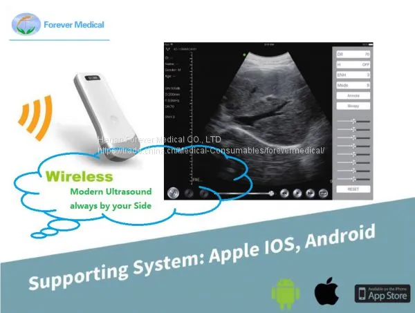10MHz Apple Ios Android Wireless Ultrasound Probes Ultrasound Scanner photo-3