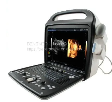 Premium 4D Color Doppler Ultrasound Scanner photo-3