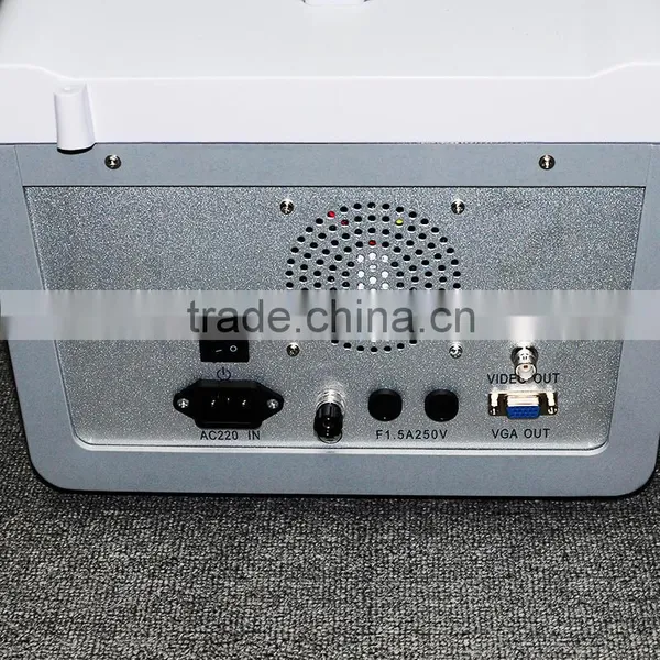 New Ultrasound Machine / Scanner Portable Ultrasonic Diagnostic System RUS-6000D With 3.5MHz Convex Probe Manufacturer photo-5