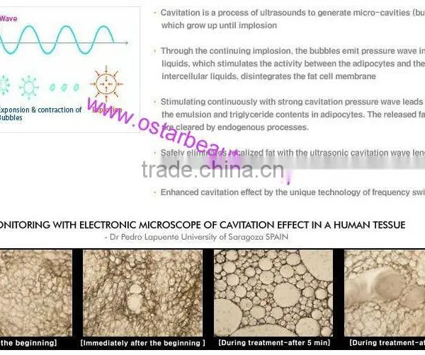 HOTSALE!! the Best Quality Home Cavitation Machine OB-C01 photo-4