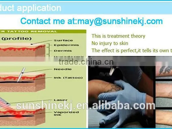 Portable Tattoo Removal Machine With 1064nm and 532nm(can Adjust Spot Size) photo-2