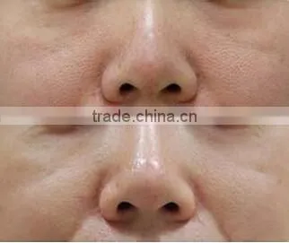 Professional PDT LED Light Facial Skin Rejuvenation Beauty Machine For Skin Rejuvenation Red Light Therapy For Wrinkles photo-5