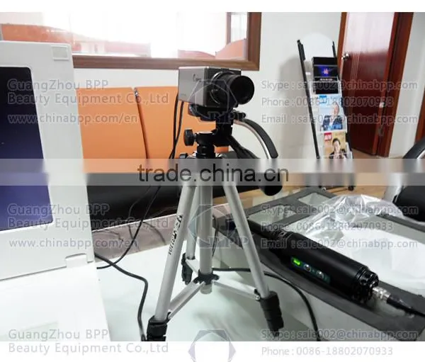 Infrared Mammary Gland Diseases Detector Women Breast Biopsy Analyzer Machine photo-4