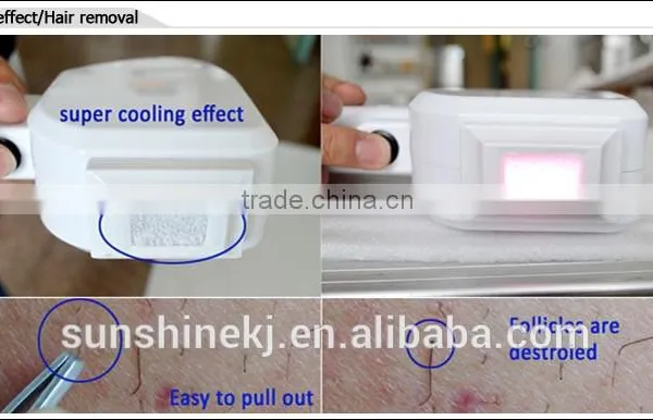 Medical CE Pain Free Skin Care Treatment Diode Laser 808nm Hair Removal photo-5