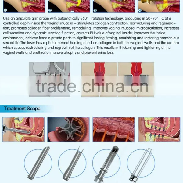 Professional CE Approval CO2 Fractional RF Laser Vaginal Tightening Machine photo-6