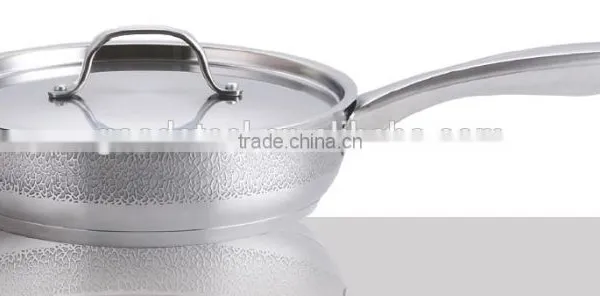8pcs Cookware Set With Electro Corrosion on Exterior MSF-3635 photo-4