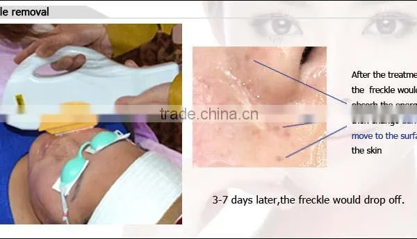 Ce Approved IPL for Face Care Beauty Machine /7 Filters photo-3