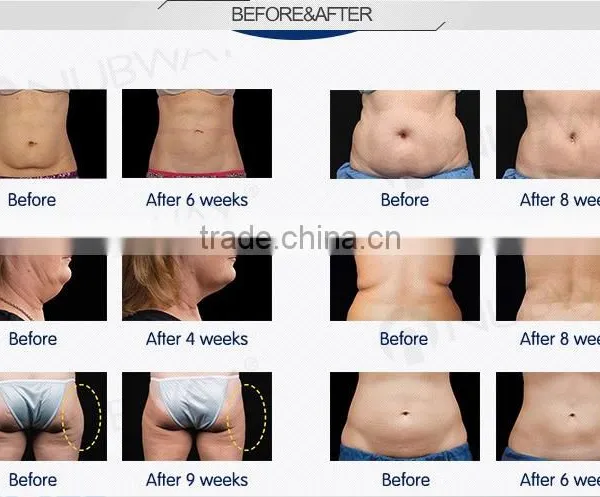 Body Reshape 2016 Professtional Best Price Cryolipolysis Fat Body Slimming Freeze Body Cool Shape Slimming Beauty Machine photo-6