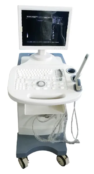 Trolly Black and Whit Ultrasound Scanner BW-5Plus photo-3