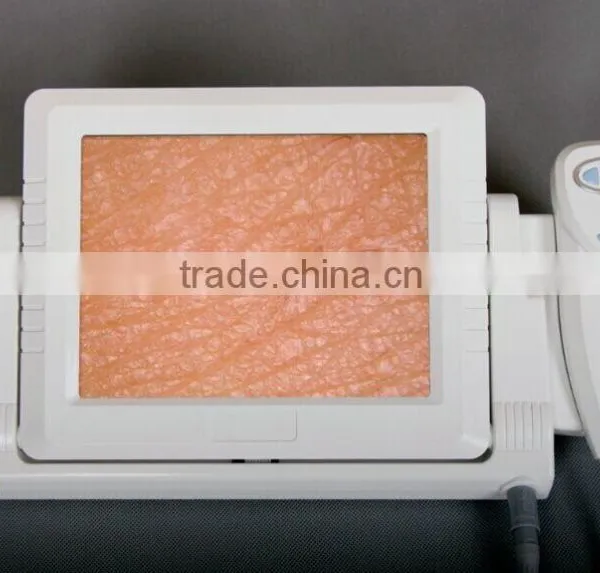 AYJ-J015 Professional Skin Analyzer Machine Skin and Hair Analysis Machine/beauty Skin and Hair Analyze Machine With Analysis photo-3