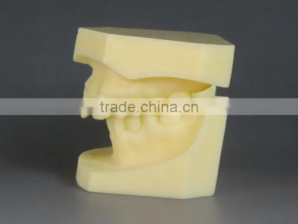 Malocclusion Classification Demonstration Model 2 photo-5