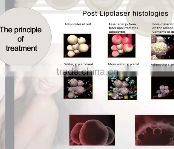 Lipolaser Slimming Machine photo-3