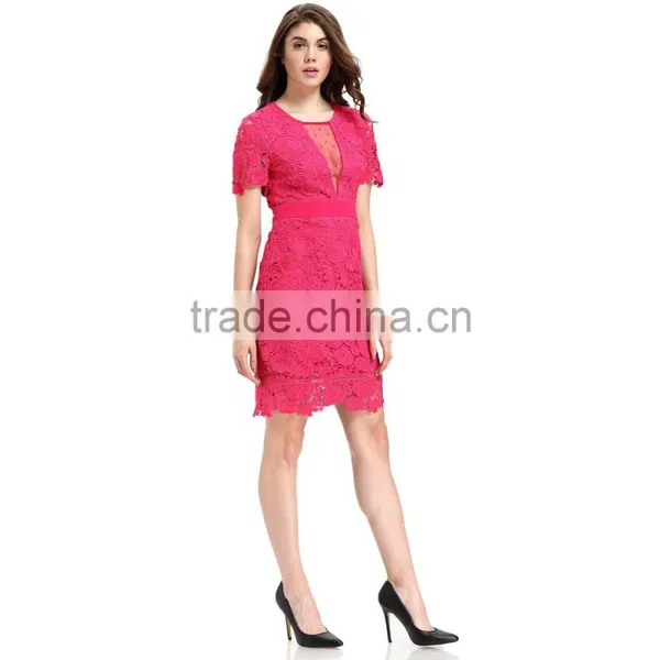 Fashion Lace Patchwork Short Frock Lady Image Skater Dress photo-5