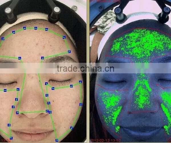 Skin Diagnosis Machine,skin Testing Equipment, Skin Analyzer photo-4