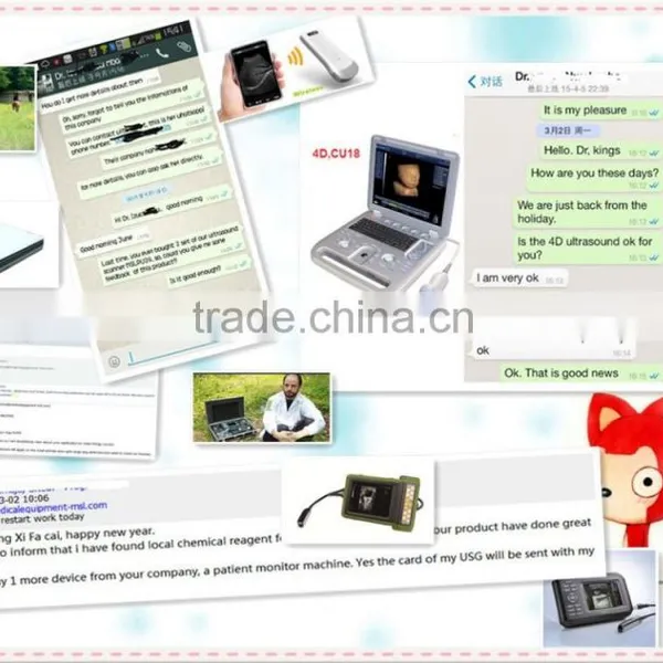 MSLPU25A HOT SALES Digital Best Medical Portable China Portable Ultrasound Machine Price photo-2