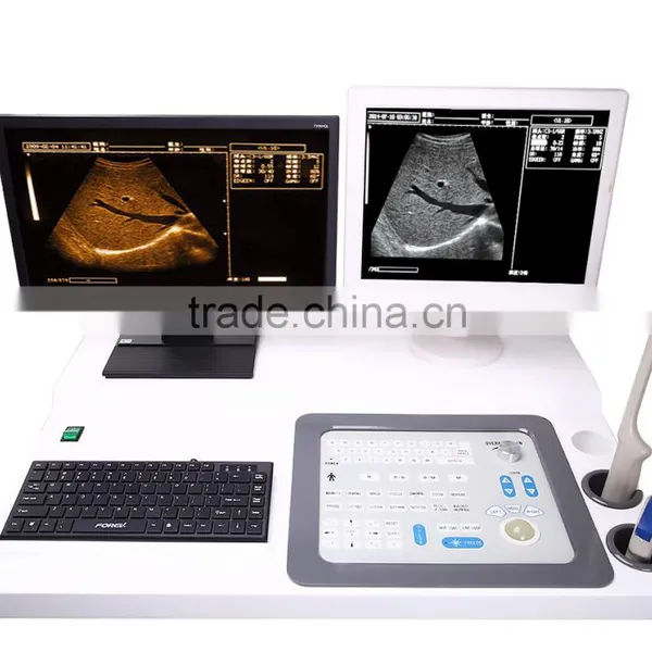 Portable Ultrasound /ultrasound Machine / 4d/3d/2d Ultrasound Scanner With Printer2018CIV photo-6