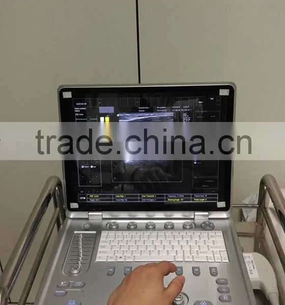 C7 KONTED 3D Portable Color Doppler Ultrasound Machine photo-2