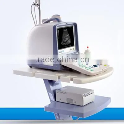 Portable USB Ultrasound scanner laptop computer