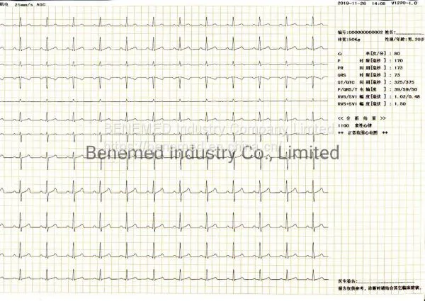 Benemed Hotsale Digital Hospital Electrocardiograph 12 Channel ECG Machine photo-5