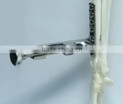 Lowman Bone Clamp/surgery Instruments Best Quality photo-4