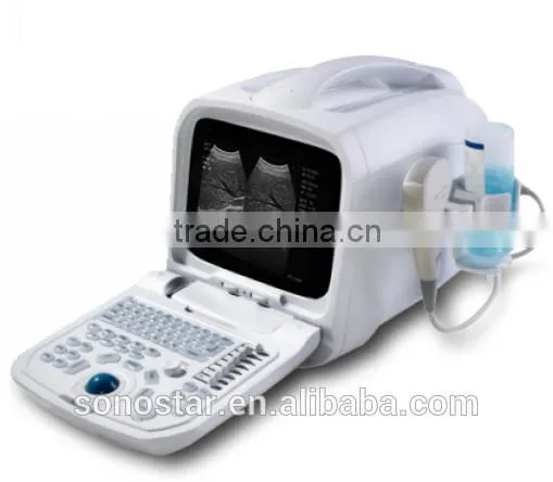 SS-7 Laptop Ultrasound Scanner photo-3
