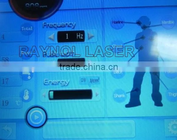 Vertical First Class Technology 808nm Diode Laser Permanent Epilation Machine photo-5