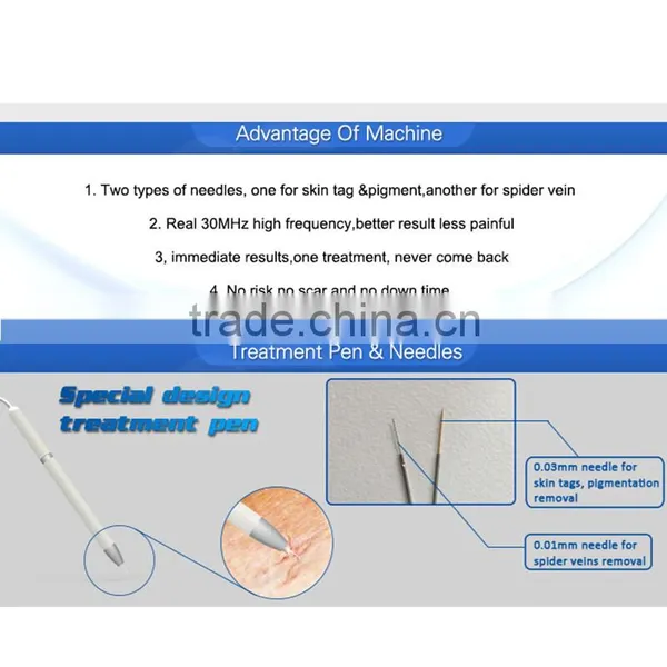 30MHz RBS Beauty Machine Coagulation Vessels Laser Blood Vessel Removal Device photo-4