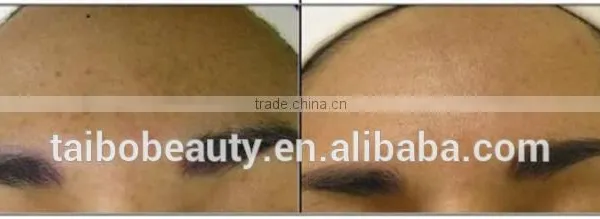 Factory Newest Skin Care Device for Spa Salon Equipment With OEM photo-4