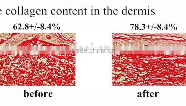 Acne Removal 590nm Yellow 2015 Hot Sale Portable Photon Therapy Multi-Function LED PDT Machine /pdt Led Light Skin Beauty Machine Skin Rejuvenation photo-4