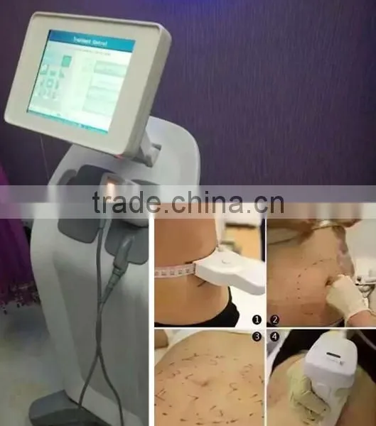 Professional Face Lift Hifu Ultra Slimming Machine With Liposonix photo-4