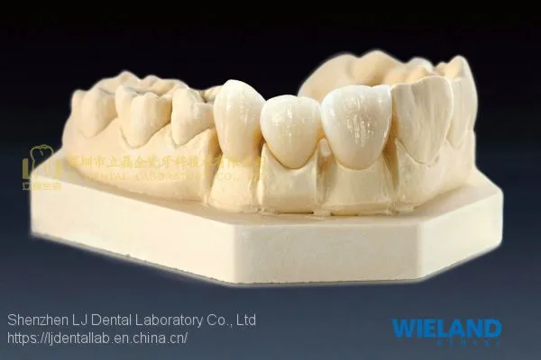 Wieland Zenostar Dental Crown, Solid Zirconia Bruxzir, Dental Teeth, Laboratoire Dentaire, Dentallabor, Laboratorio Dental, Dental Laboratory, Shenzhen LJ Dental Lab China photo-2