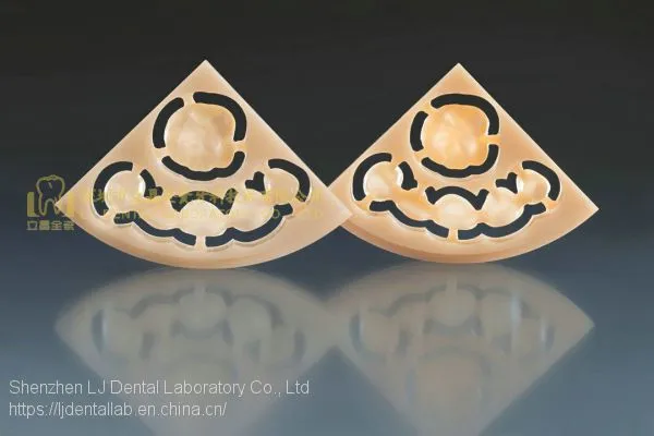 Wieland Zenostar Dental Crown, Solid Zirconia Bruxzir, Dental Teeth, Laboratoire Dentaire, Dentallabor, Laboratorio Dental, Dental Laboratory, Shenzhen LJ Dental Lab China photo-4
