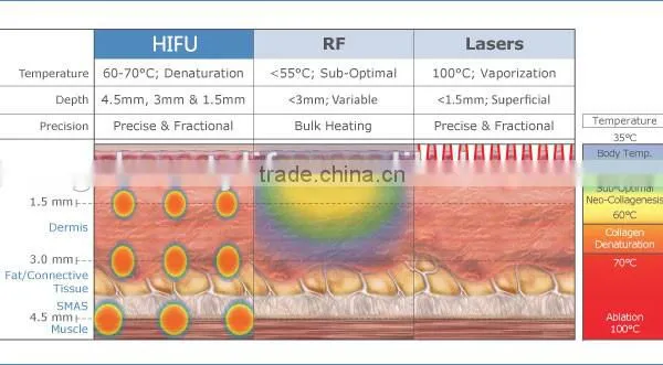 Hi Frequency Facial Machine GuangZhou BL High Intensity Focused Ultrasound HIFU Face Lifting Waist Shaping And Fat Removal Machine With CE High Focused Ultrasonic photo-6