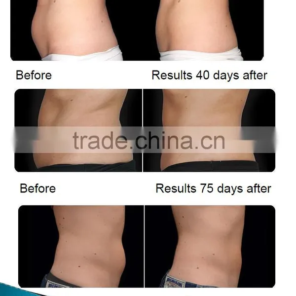 Newest CE Certification Cryotherapy Machine Fat Freezing Slimming Machine photo-6