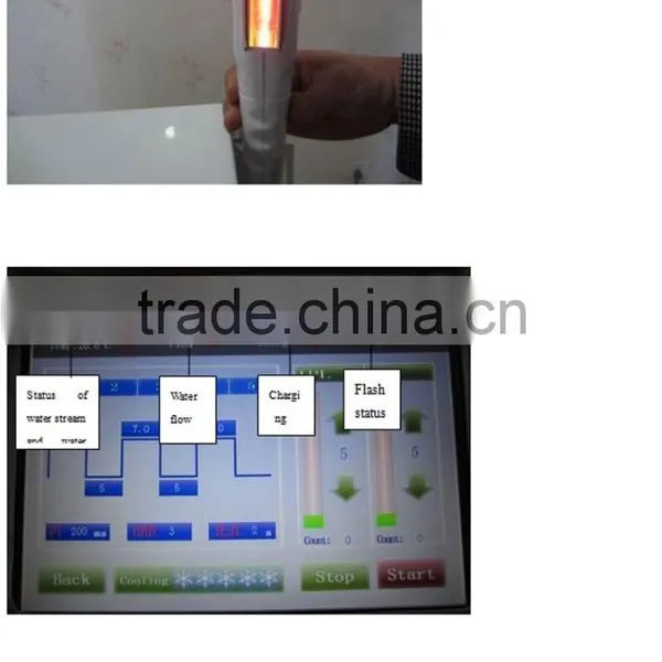 1 HZ E-LIGHT Treatment High Quality Q Switched Nd Yag Laser Tattoo Removal Machine Laser Tattoo Removal Machine Telangiectasis Treatment photo-3